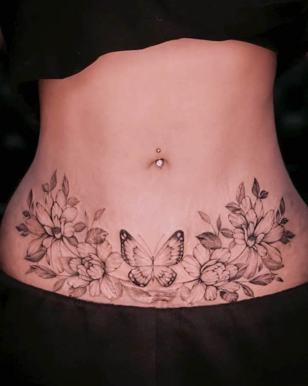 Cover-up butterfly tummy tuck tattoo